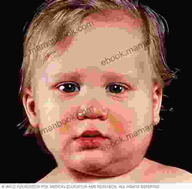 Image Of A Child With Mumps Swelling A Disease Called Childhood: Why ADHD Became An American Epidemic